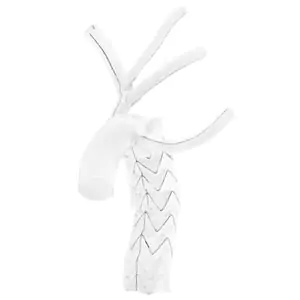 E-vita® Open Neo Hybrid Stent Graft System