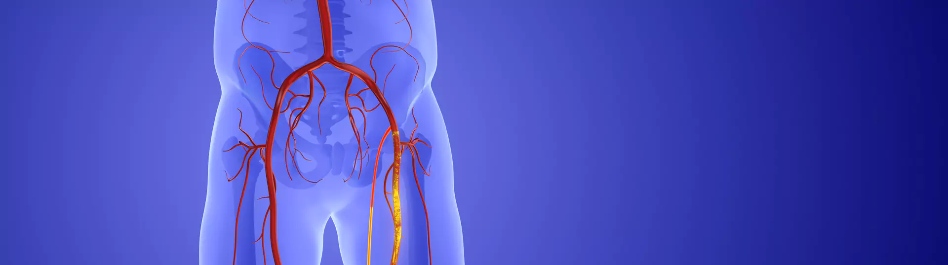Peripheral Artery Banner Image