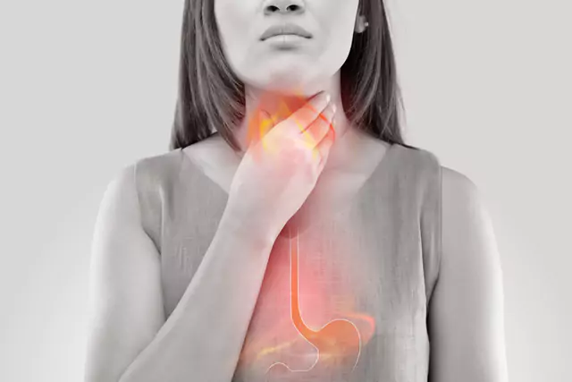 Gastric Reflux