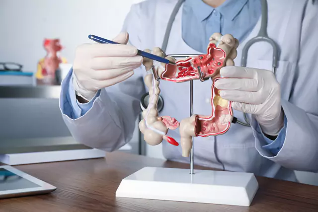 Gastrointestinal