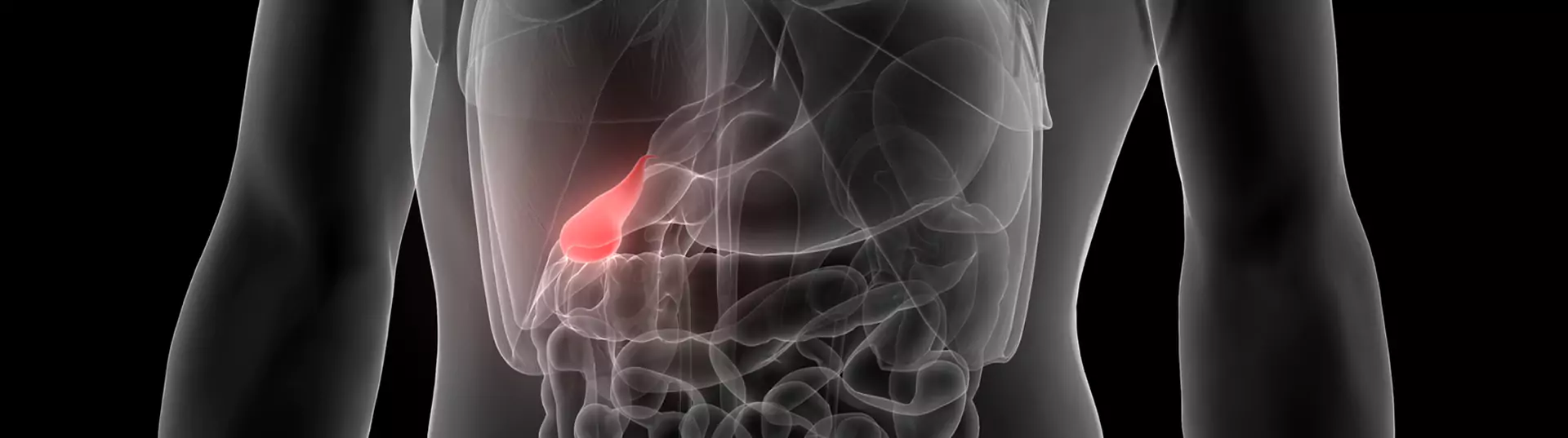 Pancreatic Stones Banner Image