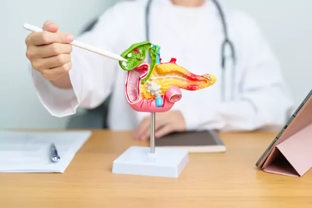 Pancreatic Stones