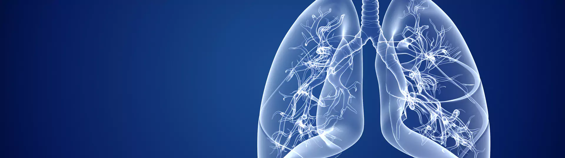 Pulmonary Embolism Banner Image