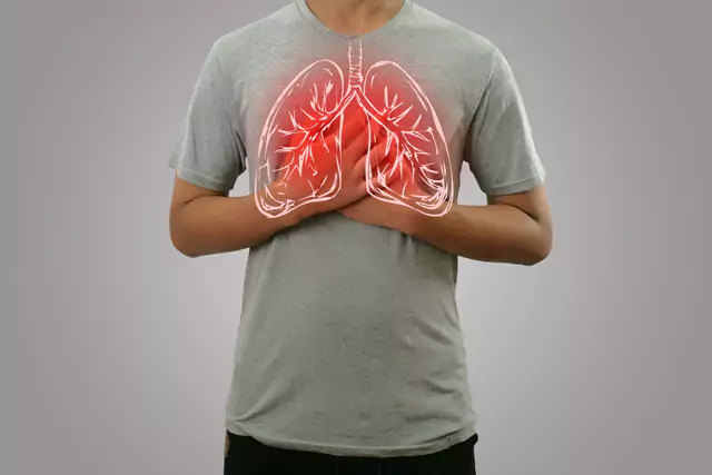 Pulmonary Embolism